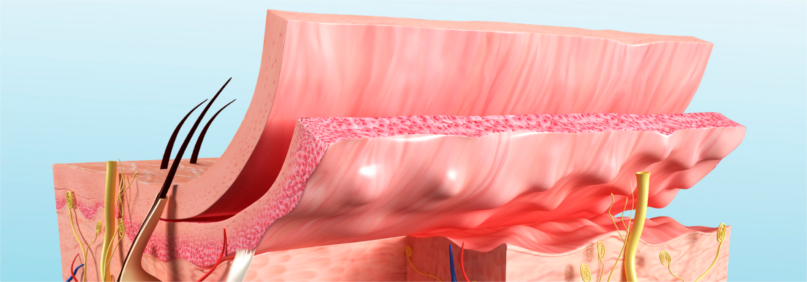 Det ytterste laget av huden består av epitelvev av typen overflateepitel