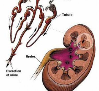 Glomerulonefritt (nyrebetennelse) Glomerulonefritt (nyrebetennelse)