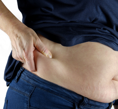 Vanlige årsaker til fedme – er fedme arvelig?